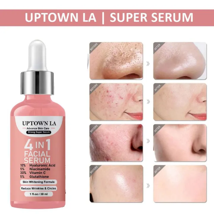 Whitening Face Serum For Girls & Women – All Skin Types
